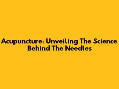 Acupuncture: Unveiling The Science Behind The Needles