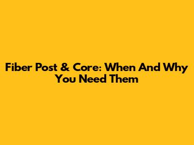 Fiber Post & Core: When And Why You Need Them