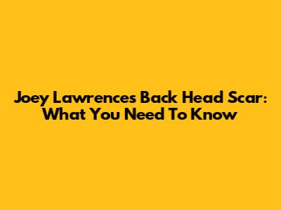 Joey Lawrence's Back Head Scar: What You Need To Know